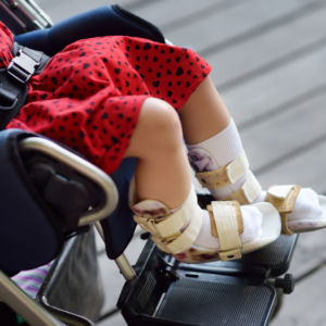 legs of a girl with cerebral palsy sitting in her wheelchari
