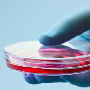 hand in a blue rubber glove holding a petri dish containing stem cells