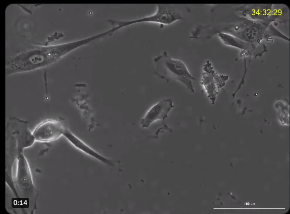 black and white image of mesenchymal stem cells derived from umbilical cord blood