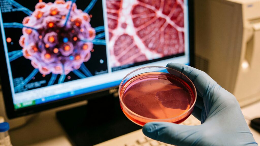 stem cell therapy for knees medical researcher in blue gloves holds a petri dish with red liquid in a laboratory setting, with a computer screen displaying microscopic images of a mesenchymal stem cell